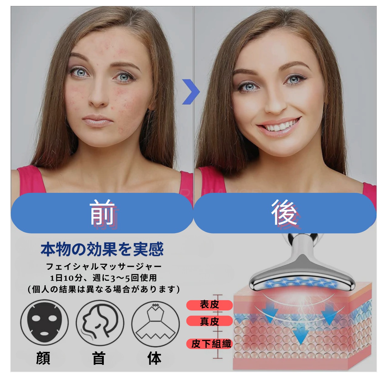 EMSフェイシャルマッサージャー – 最先端テクノロジーで肌を若返らせましょう!